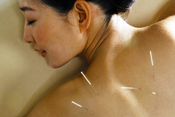 Tai Chi Akupunktur